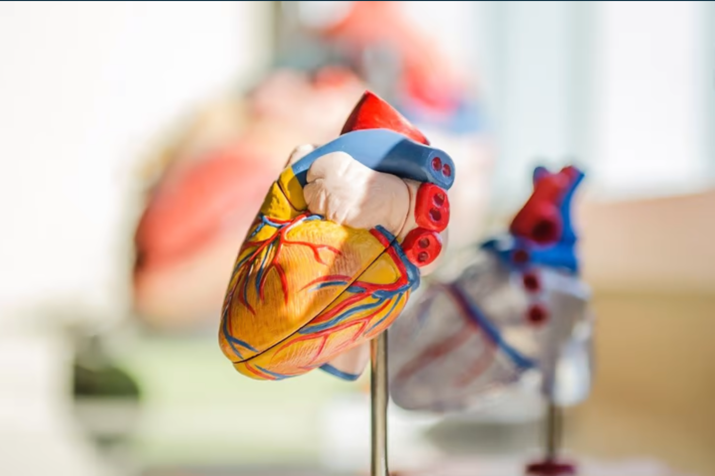 Photo of artificial heart