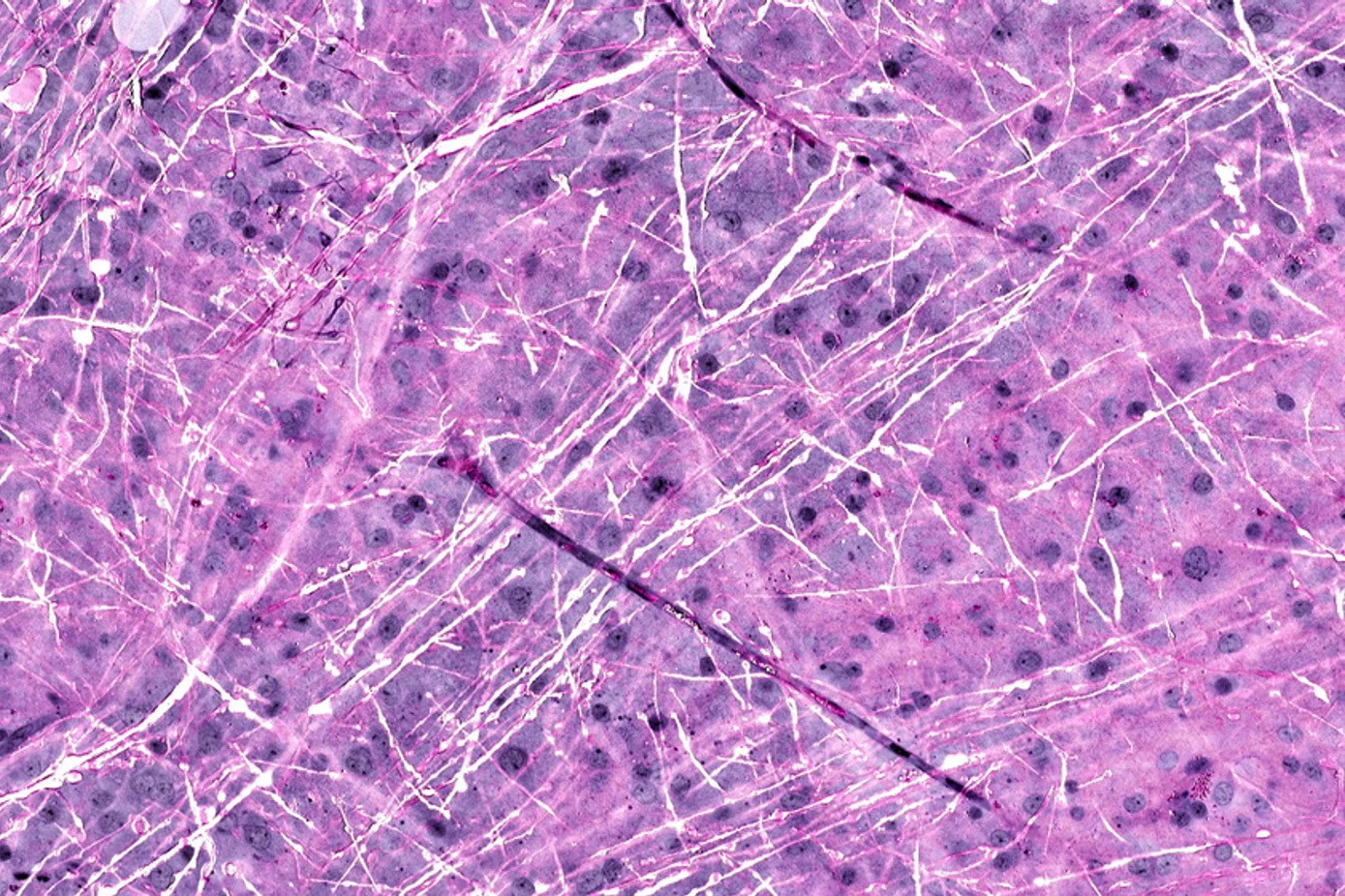 A histology image from the Invenio website